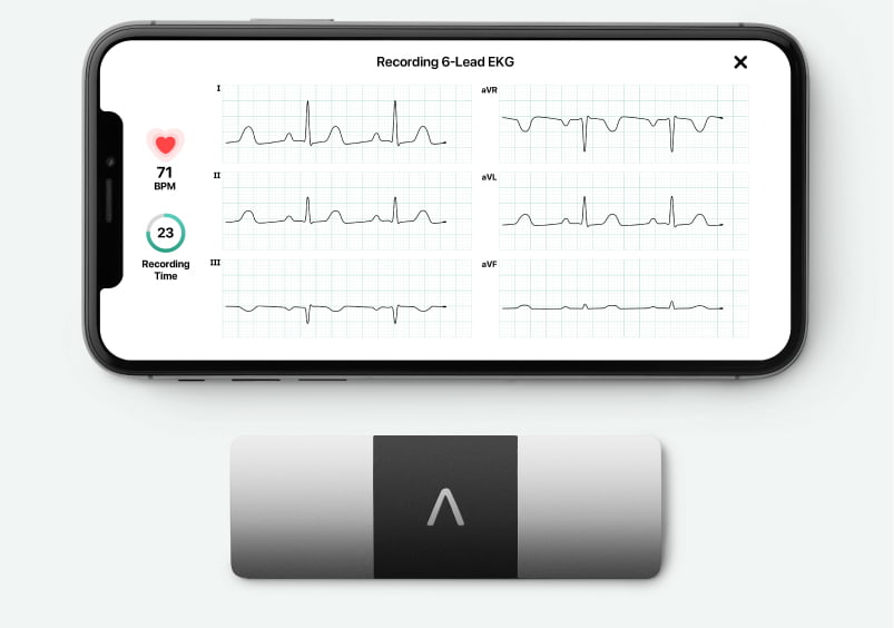 KardiaMobile 6L with an iPhone showing 6 leads