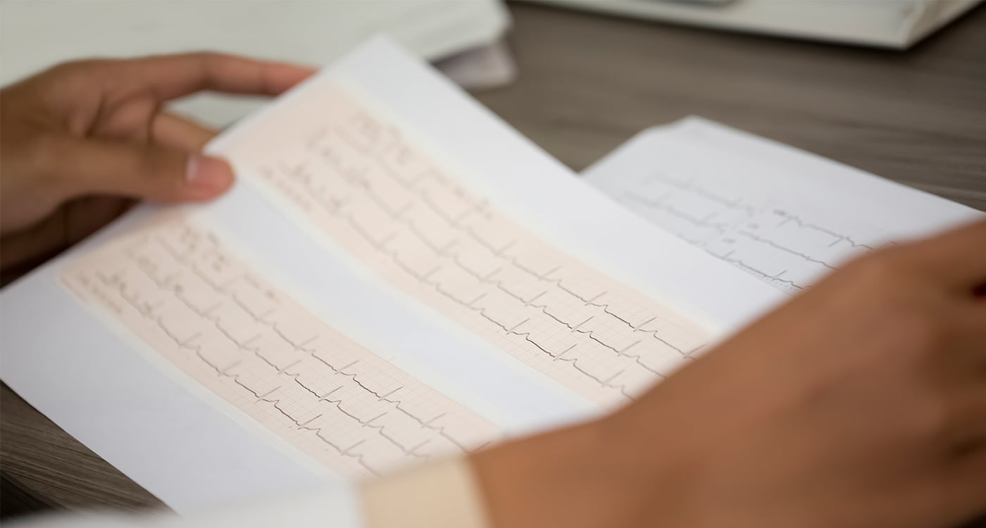 person looking at a ecg printout